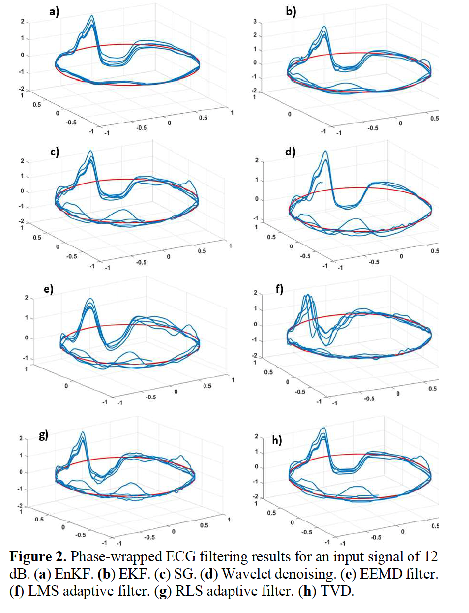 ECG Denoising with EnKF (2022)